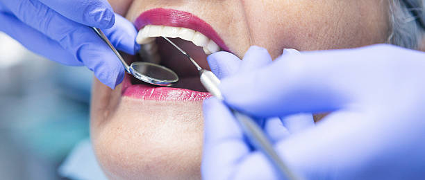 Best Emergency Treatment for Dental Infections or Abscesses in USA